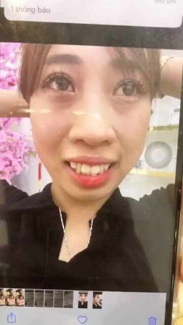 Từ Nhật về Việt Nam CHỈNH HÀM HÔ + TRƯỢT CẰM và cái kết!