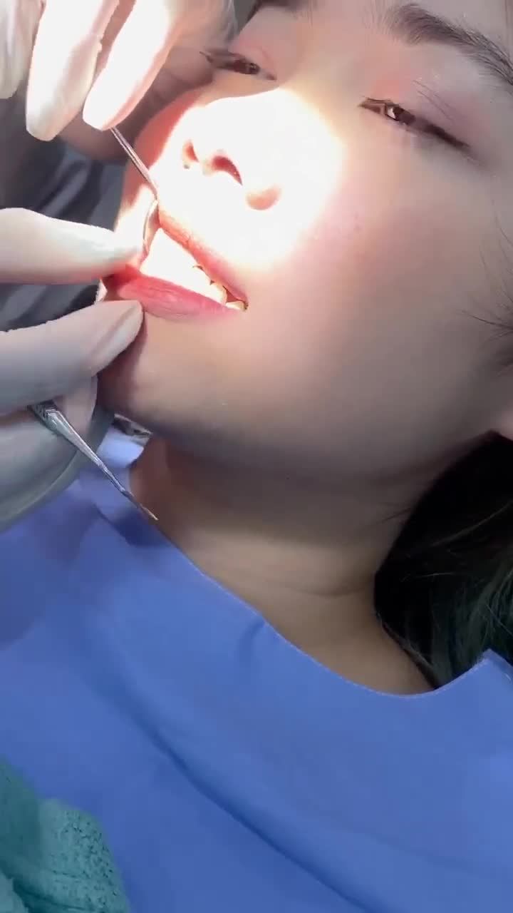 Tư vấn niềng răng cho khách hàng 18 tuổi