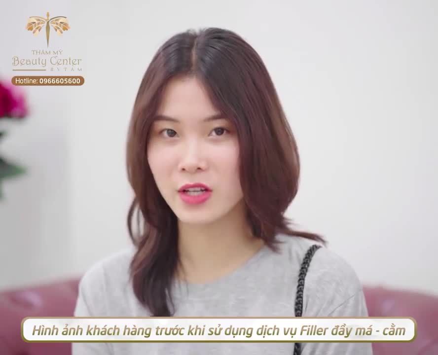 TƯƠI TẮN HƠN- TRẺ TRUNG HƠN là những lời nhận xét mà khách hàng nhận được sau khi làm Filler Má- Cằm.