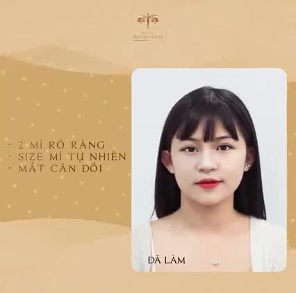 Xem ngay video này để biết tại sao mỗi ngày Thẩm mỹ Beauty Center by Tấm đón tiếp hàng chục khách hàng đến tân trang lại đôi mắt.