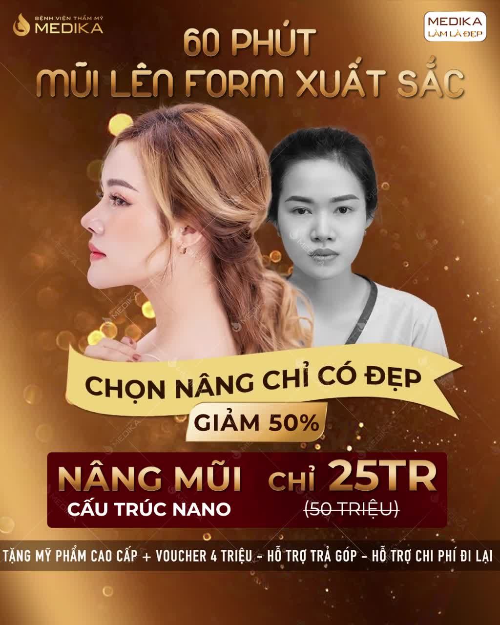 XÓA SỔ HOÀN TOÀN
