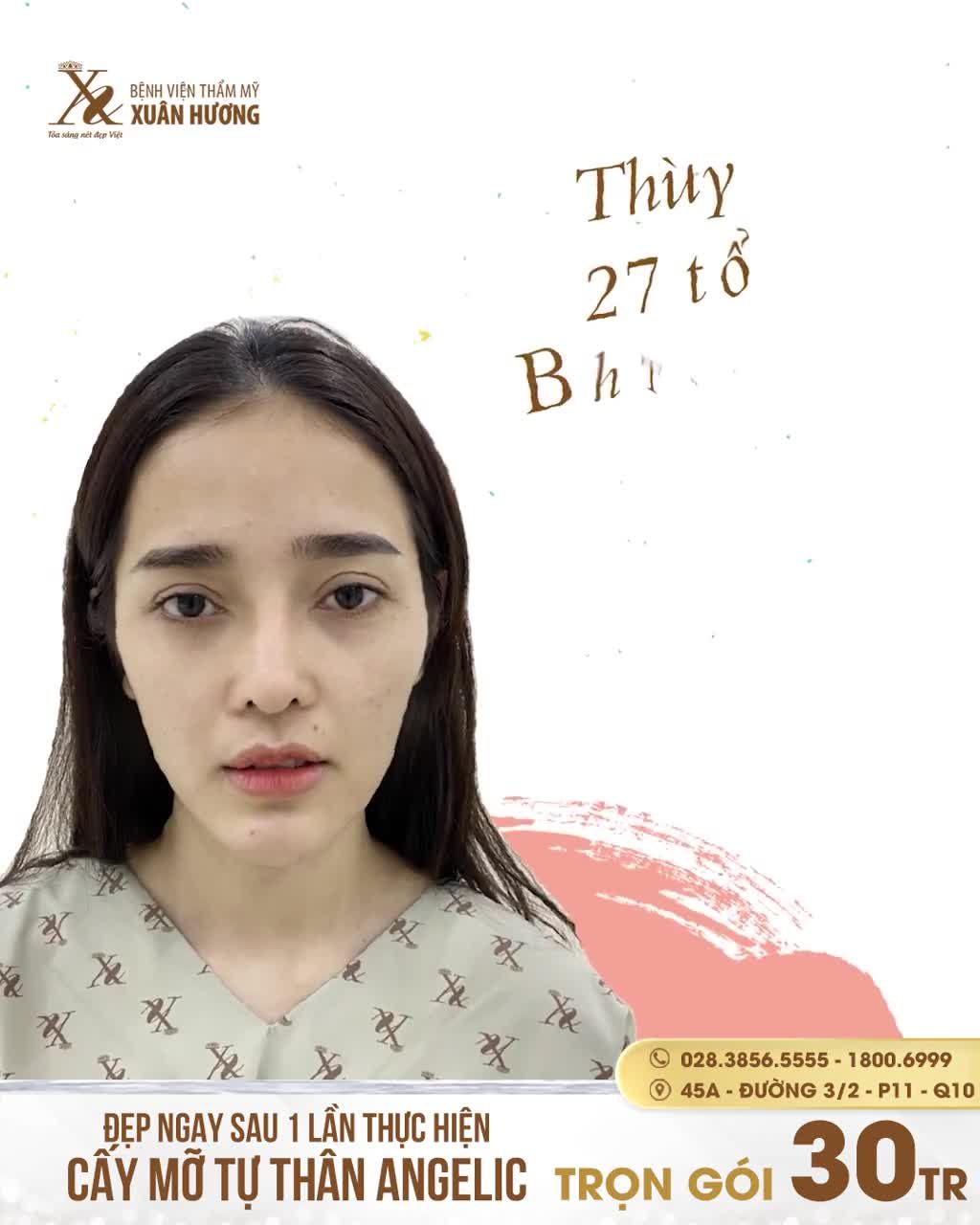 XÓA VẺ HỐC HÁC, GIÀ NUA - GƯƠNG MẶT ĐẦY ĐẶN TRẺ TRUNG