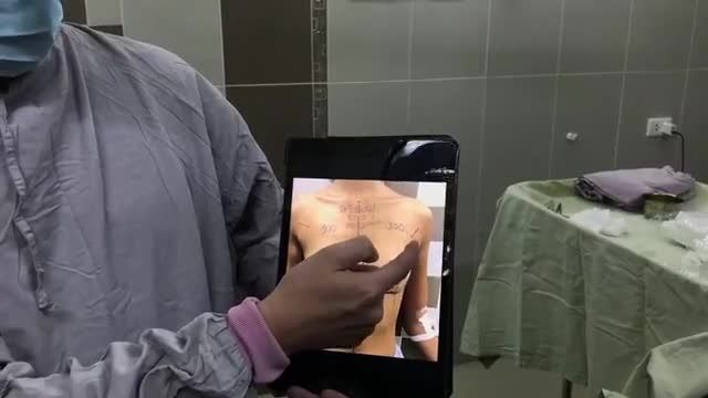 1M70 NÂNG V1 ĐƯỜNG NÀO? ĐẶT SIZE BAO NHIÊU?
