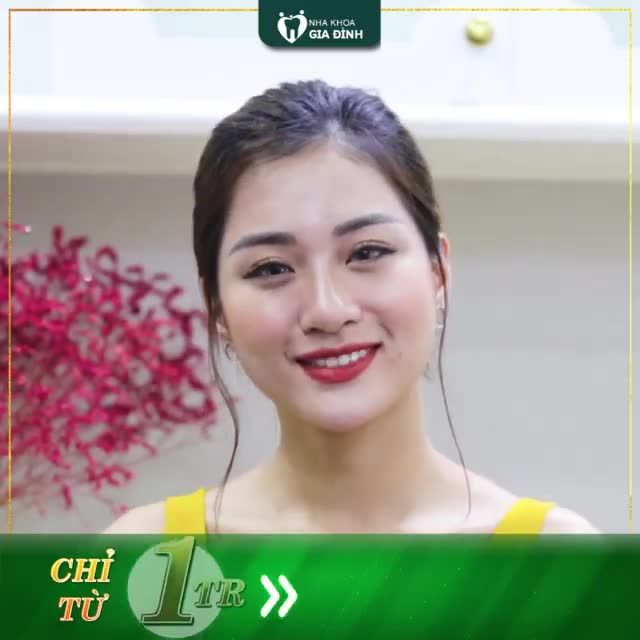 50 SUẤT THẨM MỸ RĂNG SỨ GIÁ CHỈ TỪ  1TRIỆU