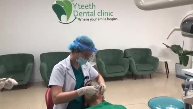 ĂN UỐNG THẾ NÀO KHI NIỀNG RĂNG