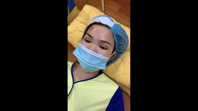ca cắt mí trên mí dưới và tạo hình sẹo