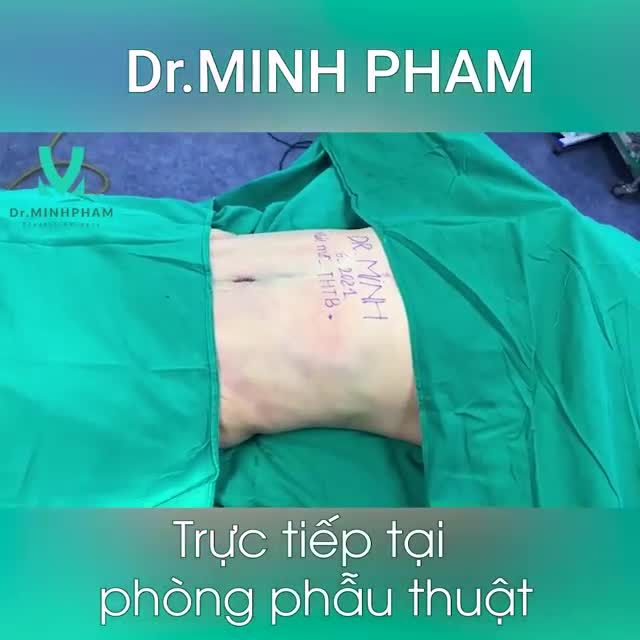 ca hút mỡ bụng, các bạn cùng theo dõi nhé .