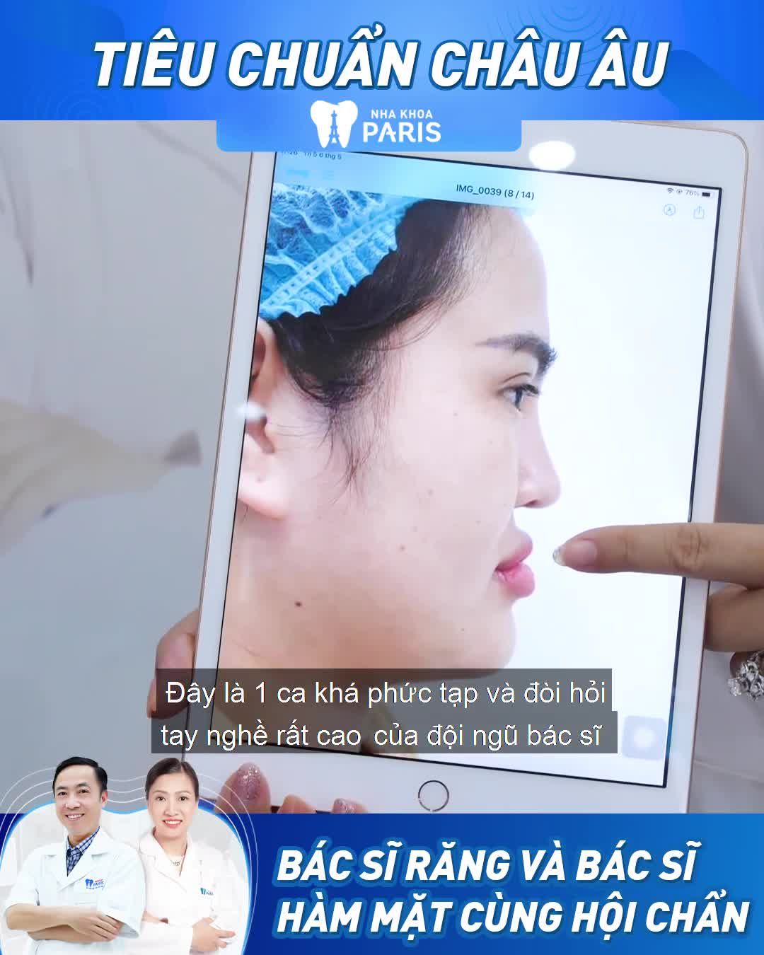 Ca MÓM NẶNG lần đầu được BỘ ĐÔI chuyên gia răng và hàm mặt hội chẩn