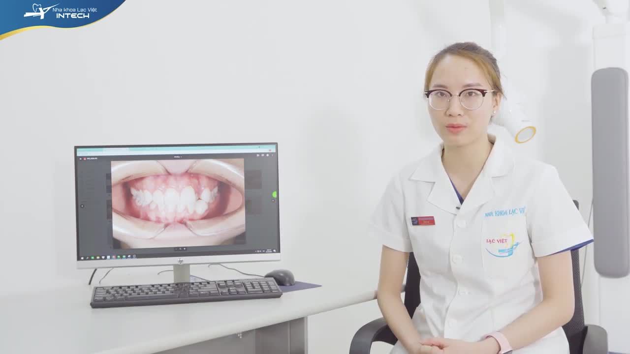 CA NIỀNG RĂNG CHEN CHÚC NẶNG VÀ THAY ĐỔI CHỈ SAU 4 THÁNG ĐIỀU TRỊ TẠI NHA KHOA LẠC VIỆT INTECH