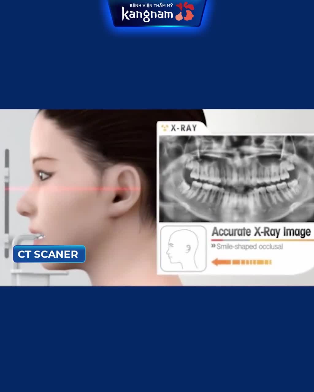 CHỈNH HÀM mà không biết tới 3 YẾU TỐ AN TOÀN hàng đầu thì dở rồi!