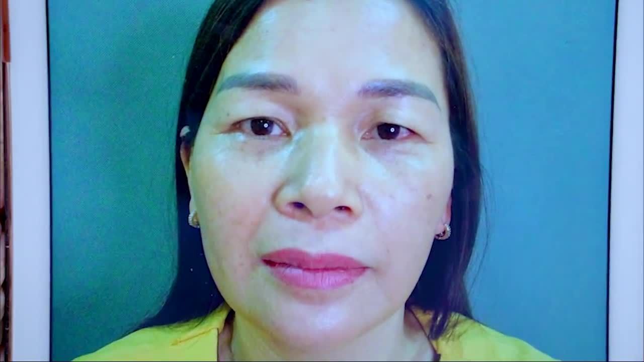 Combo Nâng cung mày + Cắt mí dưới giúp bạn trẻ trung rạng rỡ như thế nào?
