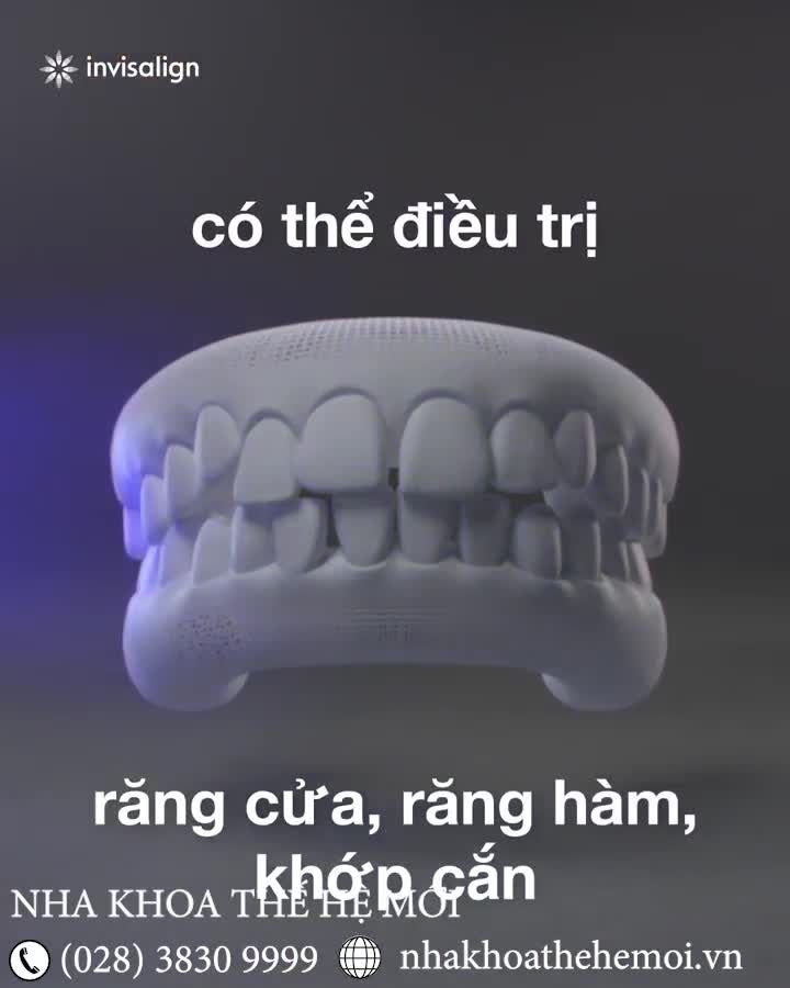 Cùng với miếng đệm răng SmartForce, Invisalign hoàn toàn có thể mang lại hiệu quả niềng răng như mắc cài truyền thống.