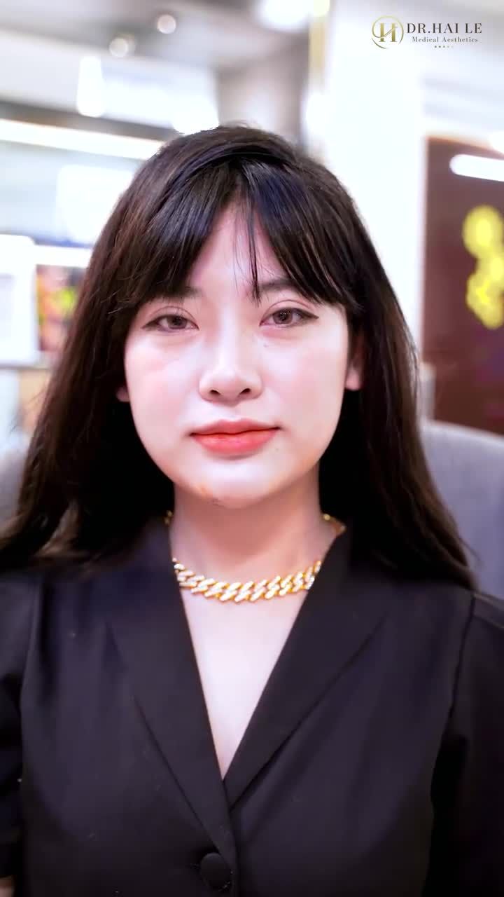 Dáng cằm xinh cho gương mặt thêm lung linh.!