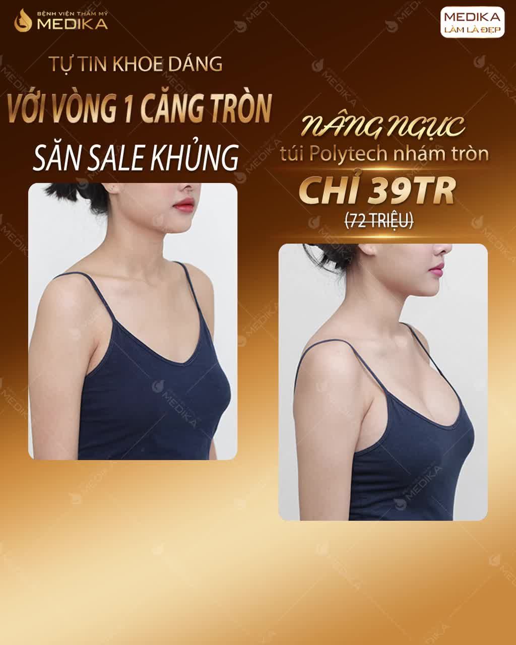 ĐIỂM TUYỆT ĐỐI VỚI VÒNG 1 CĂNG TRÀN, HÚT MẮT