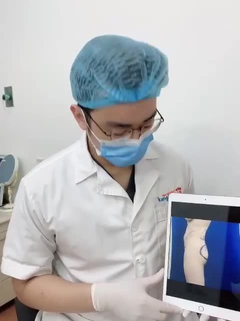 "ĐỘ DÁNG" quyến rũ - chọn NÂNG MÔNG TÚI ĐỘN