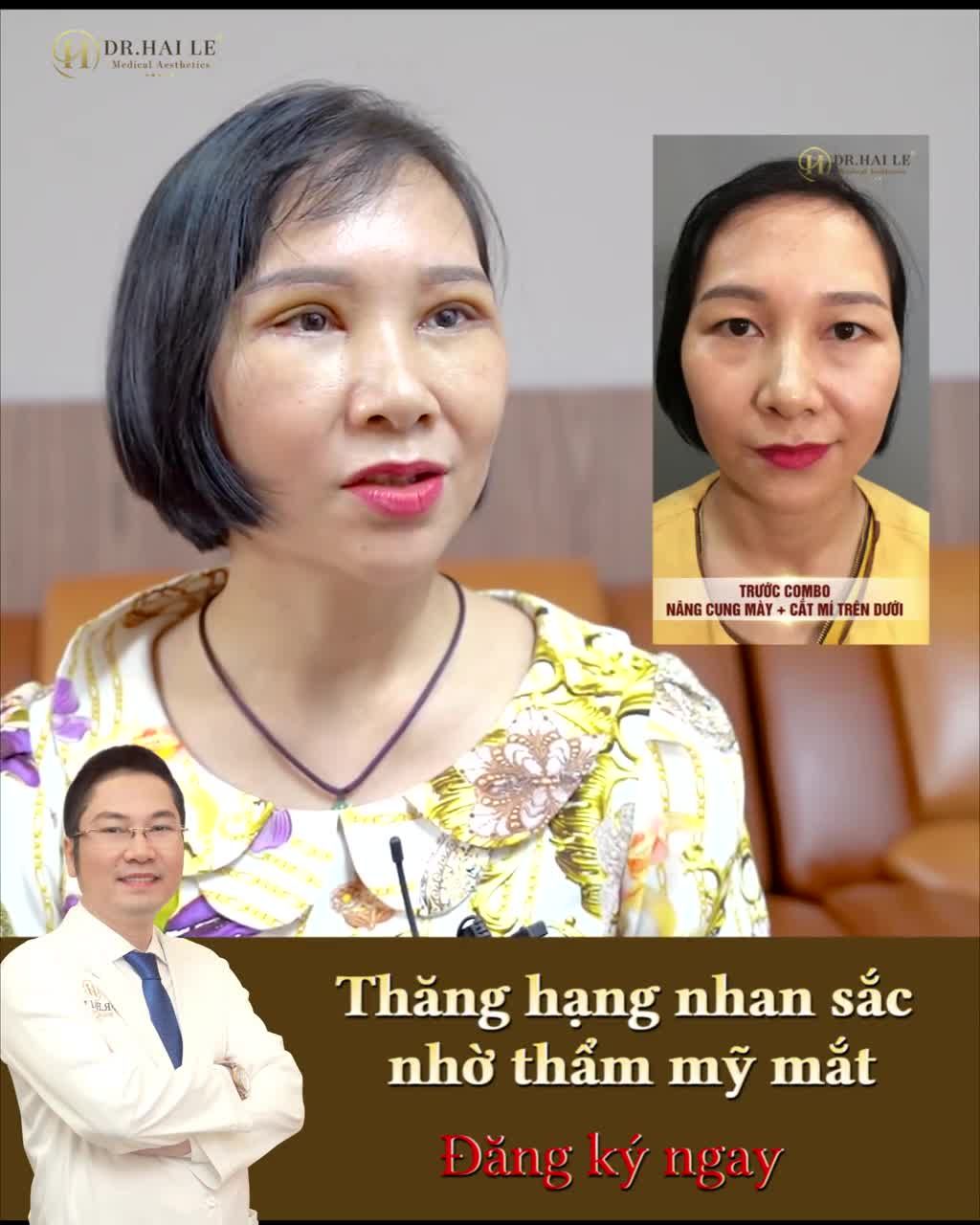 Đôi mắt của bạn có đang gặp tình trạng sụp mí, mỡ dư hay khuyết mỡ gây già nua u buồn?