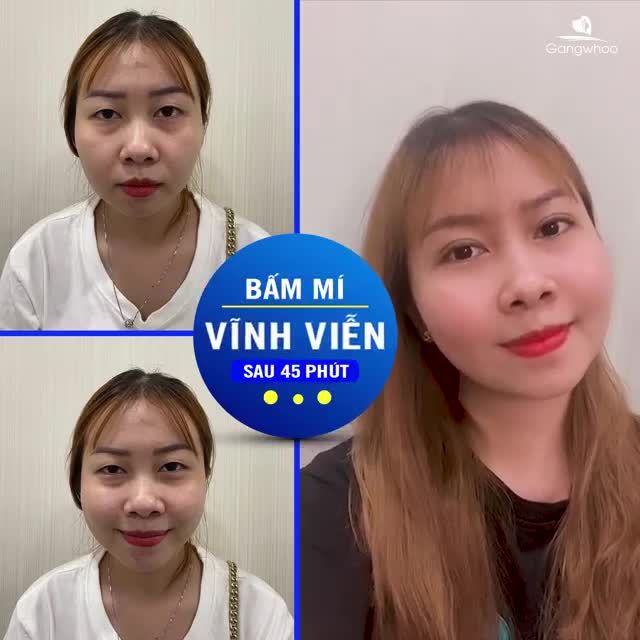 ĐÔI MẮT TƯƠI TRẺ LÀM BỪNG SÁNG CẢ KHUÔN MẶT