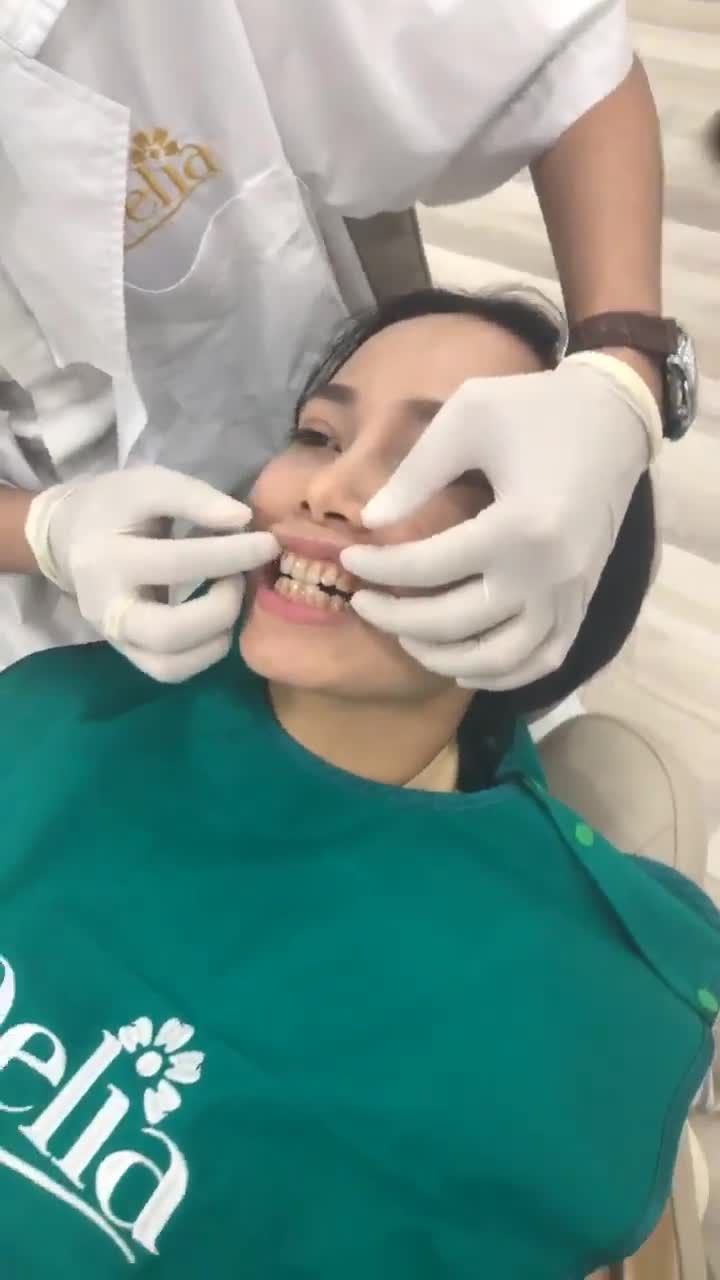Đối với Delia: Thẩm mỹ răng sứ phải là hoàn hảo nhất!