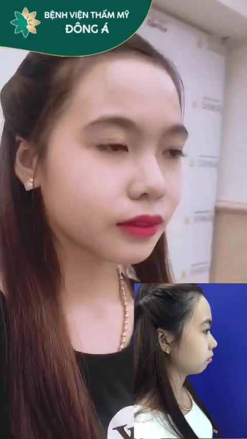 ĐỘN CẰM VLINE thách thức mọi góc mặt!