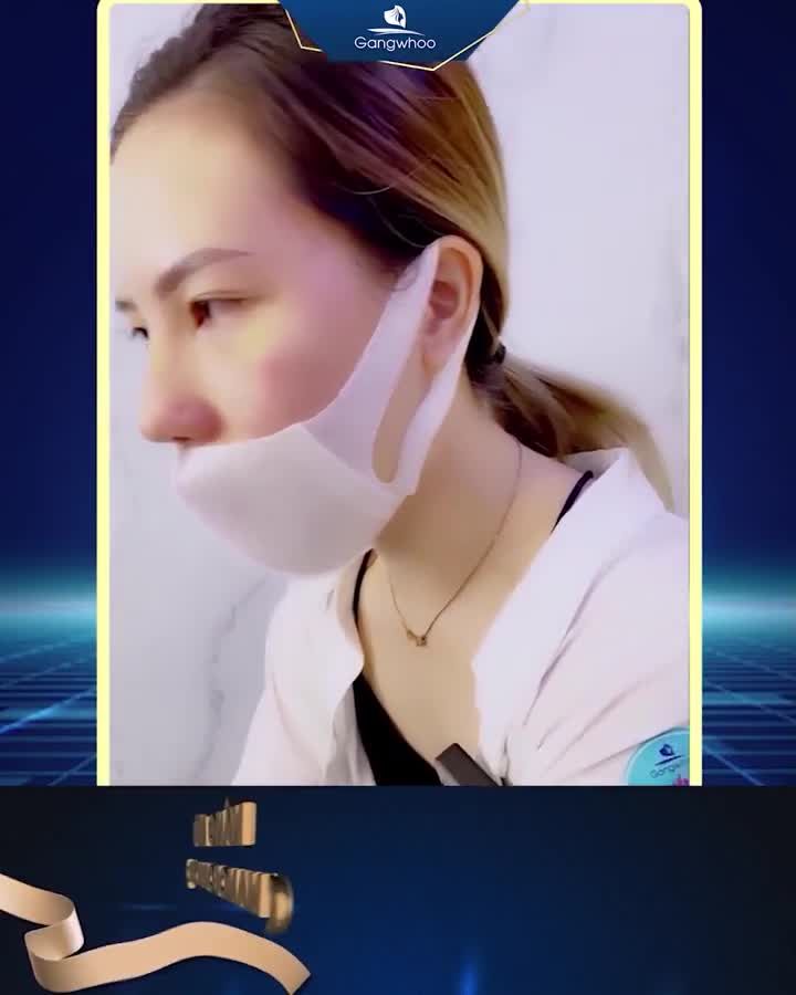 FEEDBACK KHÁCH HÀNG NÂNG MŨI NANO 6D