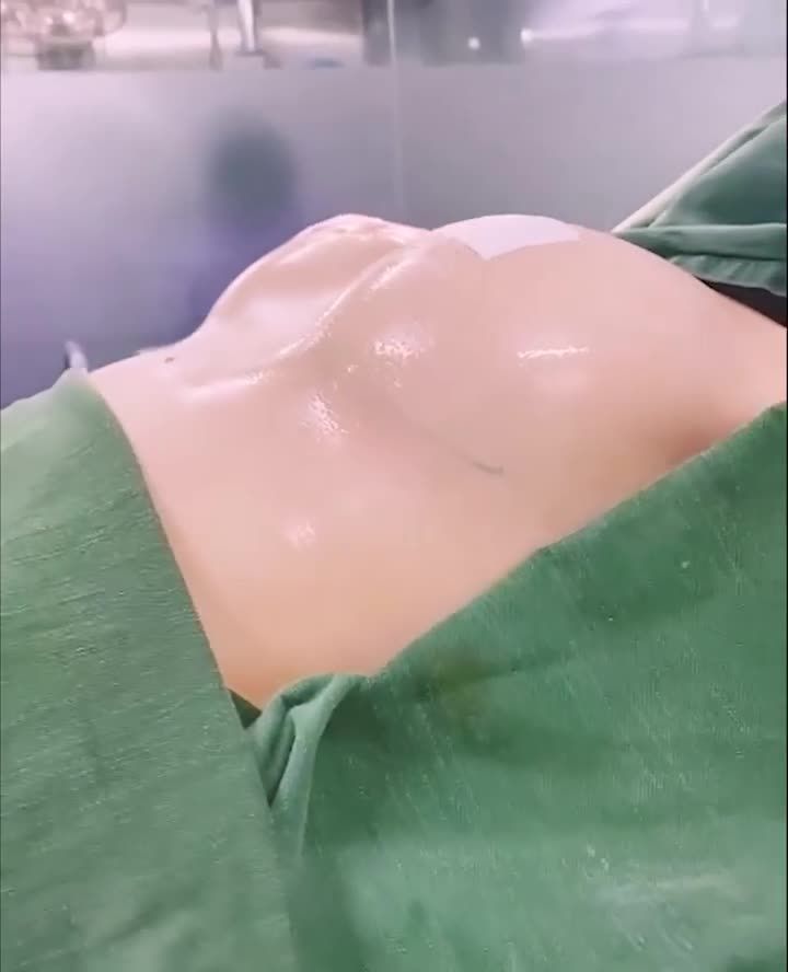 GIẢI PHÁP CẢI THIỆN V1 LÉP- LỆCH- SỆ