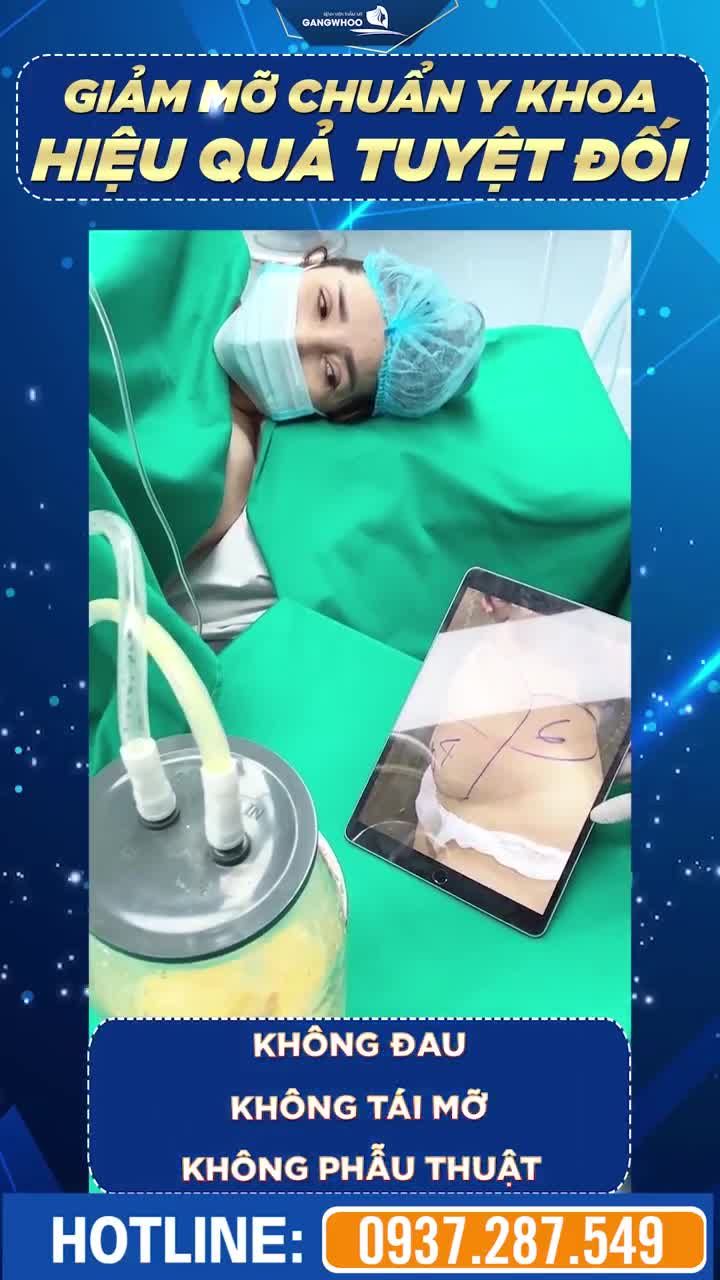 GIẢM MỠ THẦN TỐC – TỰ NHIÊN – KHÔNG CẦN THUỐC