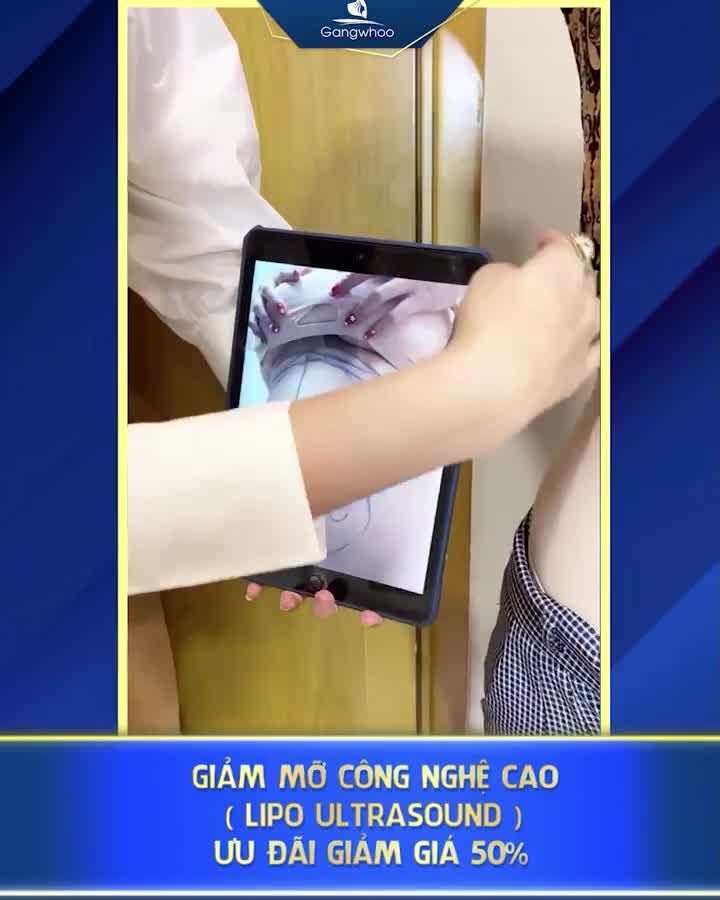 GIẢM MỠ TOÀN THÂN – THOẢI MÁI KHOE EO XINH