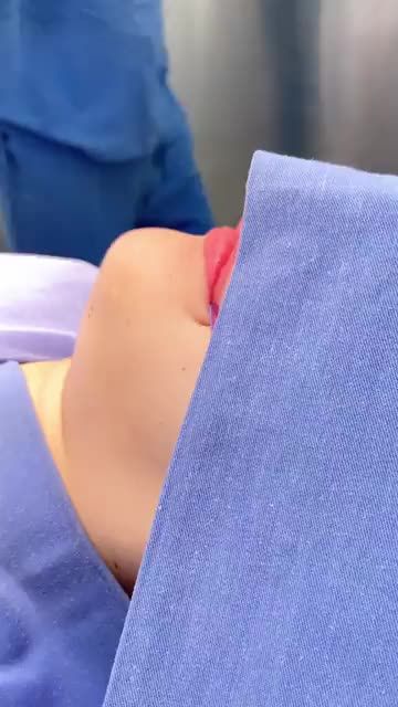 HÀM VUÔNG TO BẠNH - CẰM NGẮN GIẢI PHÁP NÀO CHO MẶT THON GỌN TỰ NHIÊN?