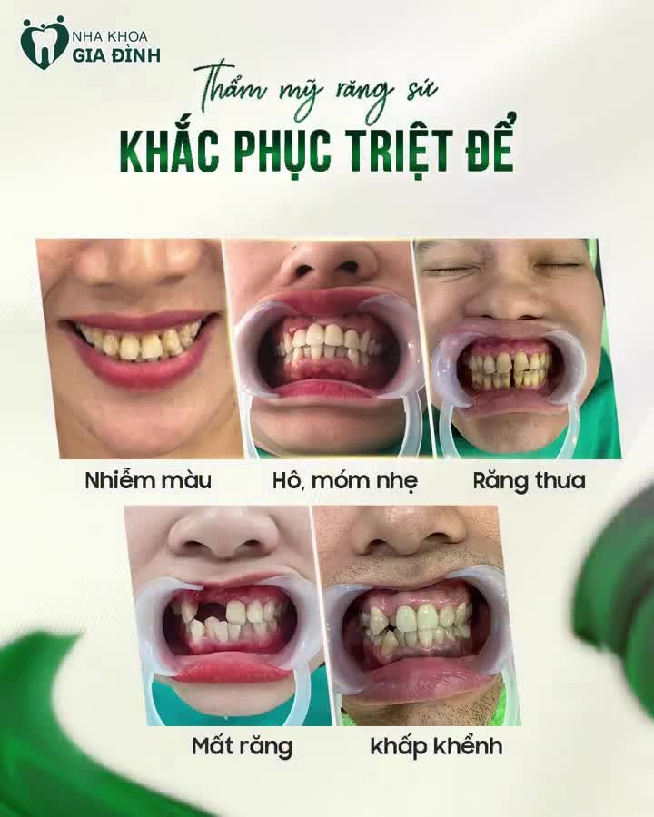 Hồng Nhung đã có hành trình thăng hạng nhan sắc của mình như thế nào nhé!
