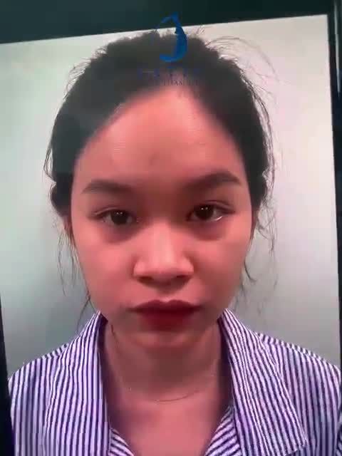 Khác biệt và tươi tắn ngay sau PT!