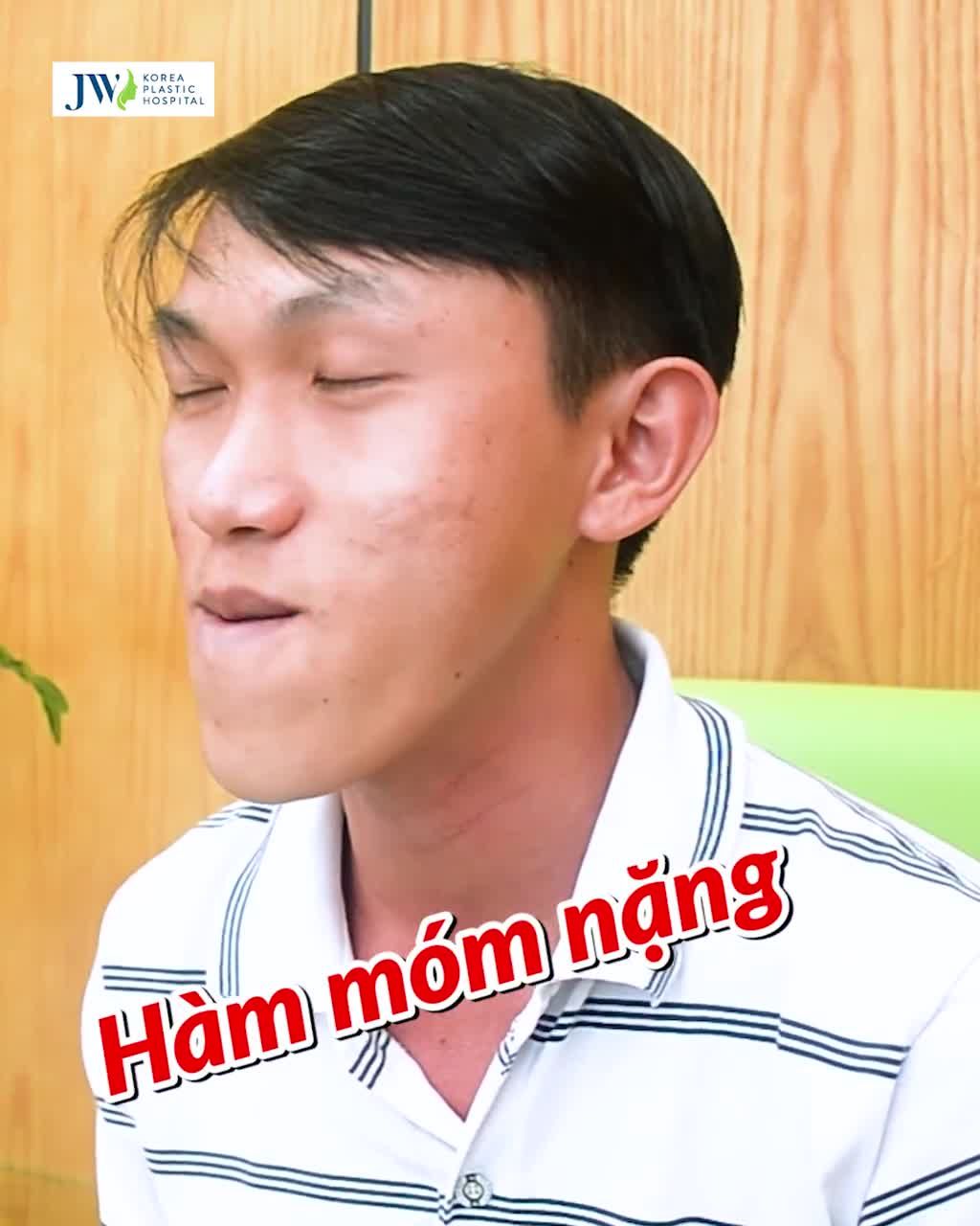 KHẮC PHỤC HÔ MÓM: 1 LẦN LÀM, ĐẸP 1 ĐỜI