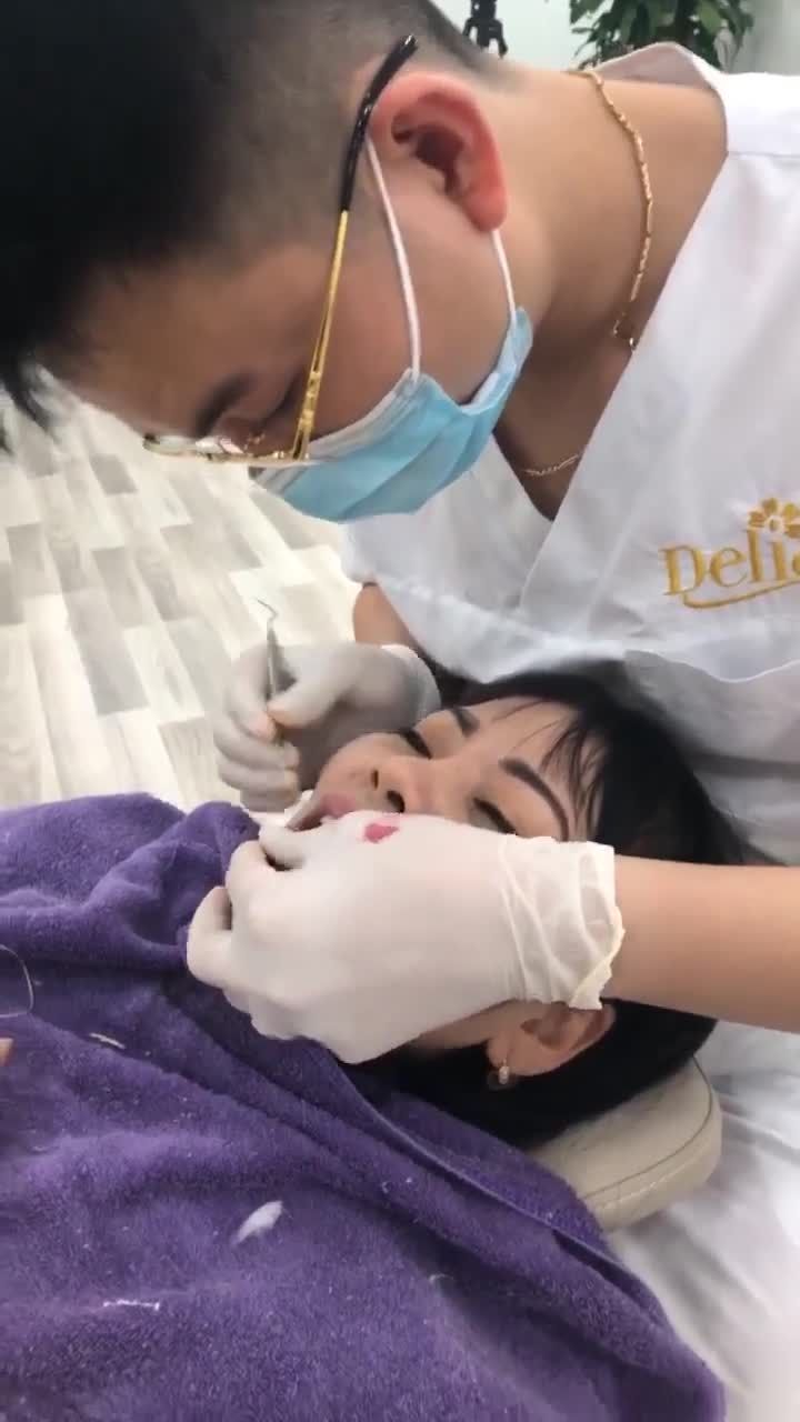 Khách hàng Nguyệt Anh thay đổi nụ cười sau thẩm mỹ DÁN SỨ VENEER 17 răng sứ: