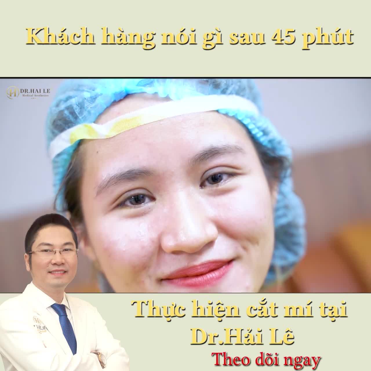 Khách hàng nói gì sau 45 phút thực hiện Cắt mí tại Dr.Hải Lê