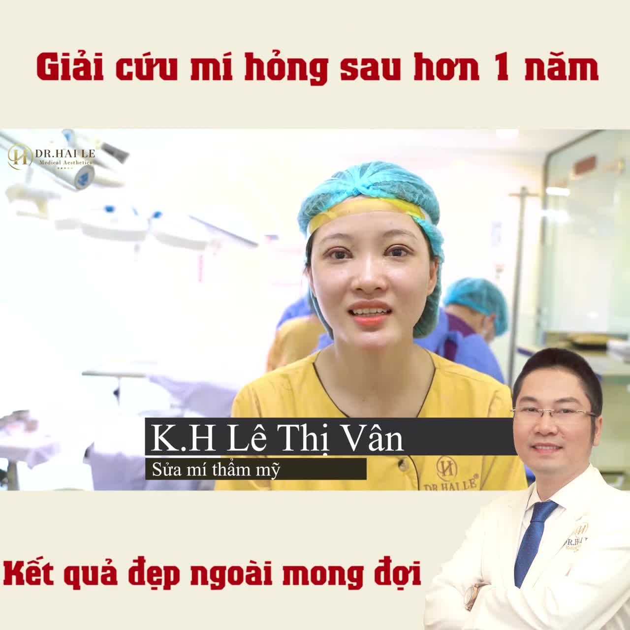 "Mãn nhãn" với kết quả SỬA MÍ LỖI HỎNG DEEPTECH20 đẹp ngoài sự mong đợi