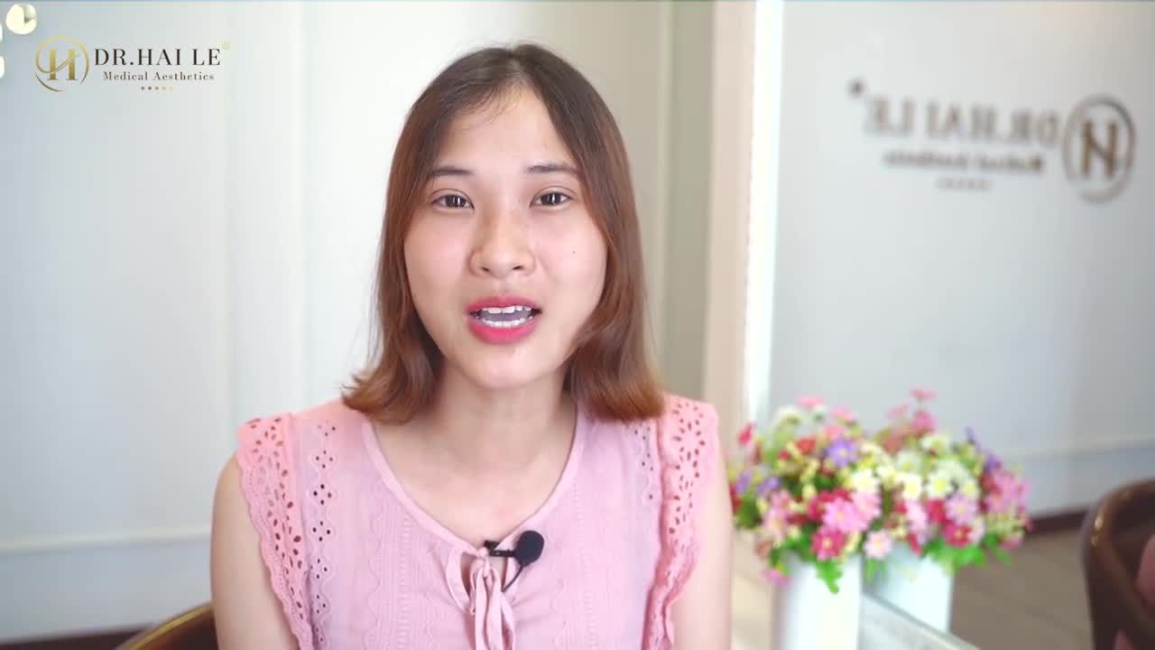 Mắt trước khi thẩm mỹ của Ngọc Huyền là mắt 1 mí