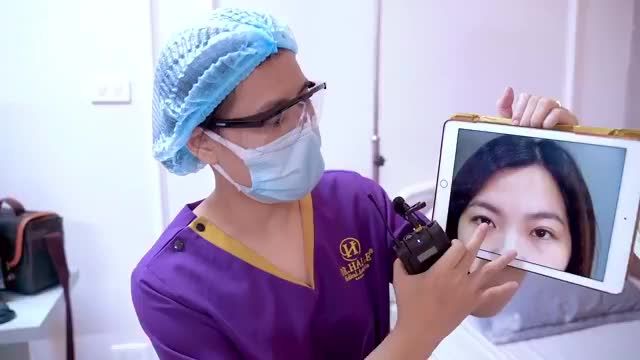 Mí mắt lệch to nhỏ được Bác sĩ tại Dr.Hải Lê khắc phục như thế nào? Mời quý khách hàng cùng theo dõi