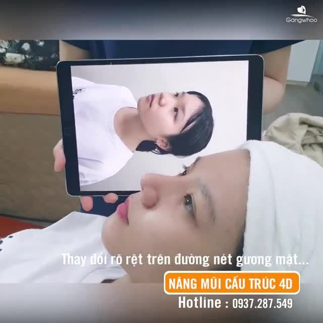 MŨI CAO SANG MANG LỘC VỀ NHÀ