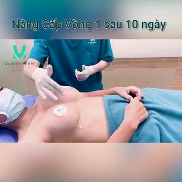 Nâng cấp vòng 1 sau 10 ngày