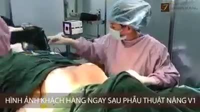 NÂNG NGỰC CĂNG TRÒN - CHẲNG CÒN TỰ TI