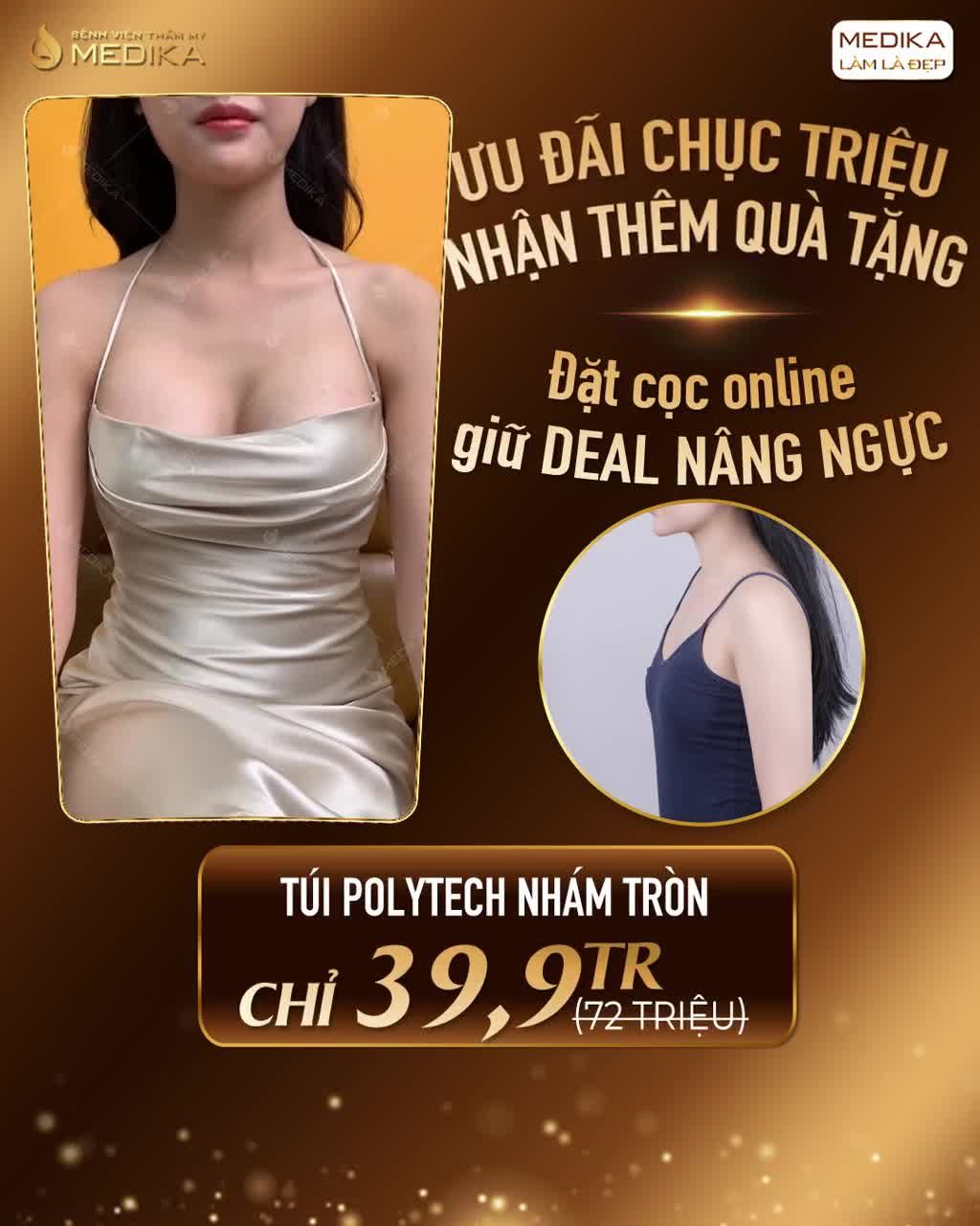 NÂNG VÒNG 1 TÚI POLYTECH NHÁM TRÒN - "THÁCH THỨC" LÉP XẸP