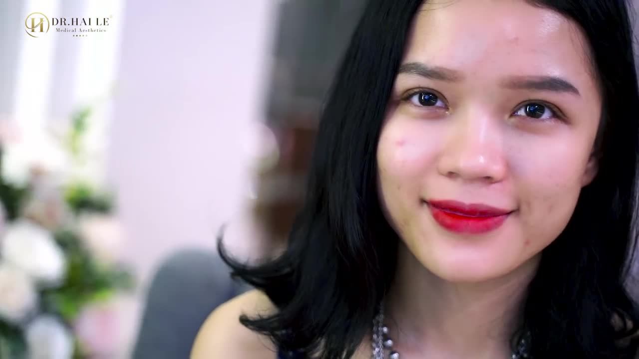 Nếu bạn đang có ý định thực hiện Cắt mí tại Dr.Hải Lê thì không thể bỏ qua video này!