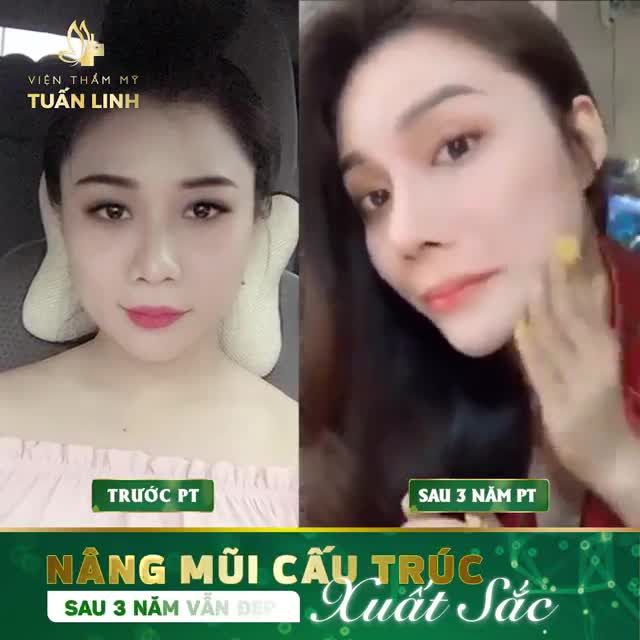Nghiêng nghiêng xinh quá! Nhìn góc này chị em đã thấy mê mẩn dáng mũi Angel line nhà Tuấn Linh chưa ạ???