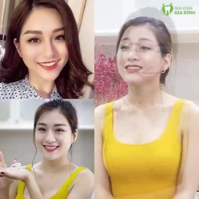 NHAI ĐÁ NGAY SAU KHI LÀM RĂNG XONG. TIN ĐƯƠC KHÔNG