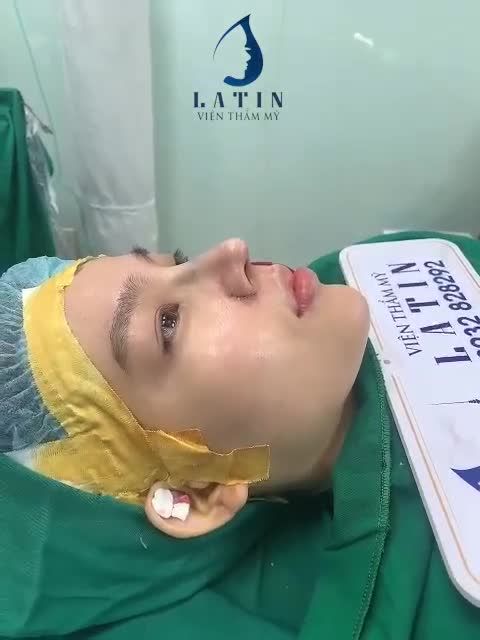 Nhẹ nhàng, tự nhiên, mềm mại chuẩn dáng mũi Latin mới vừa hoàn thiện xong đây ạ.
