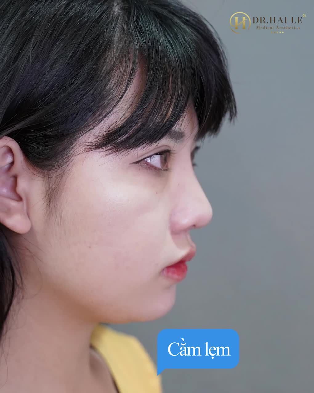 Nhìn dáng cằm thời thượng, chuẩn Hot trend của nàng ấy bảo sao các chị em lại "chao đảo" với xu hướng độn cằm V line đến vậy. Yêu thực sự