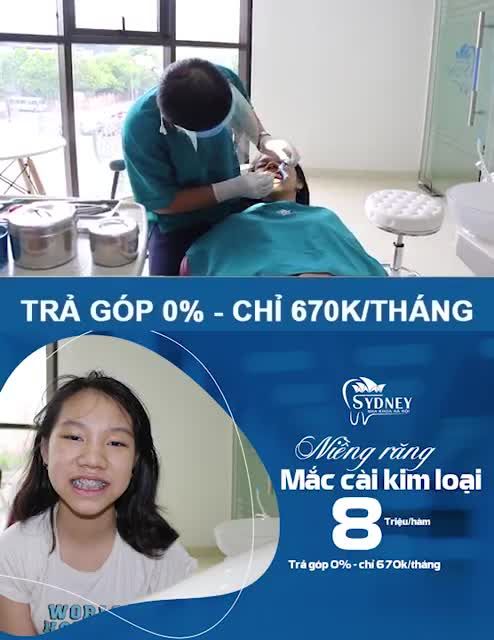 NIỀNG RĂNG MẮC CÀI KIM LOẠI