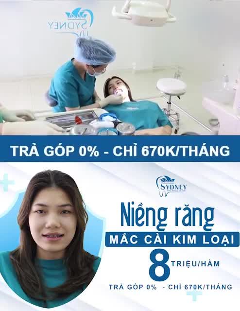 NIỀNG RĂNG PHƯƠNG PHÁP NÀO ƯA CHUỘNG NHẤT
