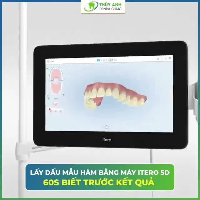 NIỀNG RĂNG QUY TRÌNH KHÉP KÍN AN TOÀN MÙA DỊCH