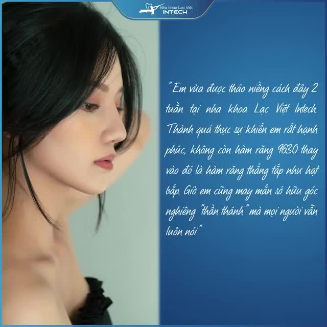 NỮ SINH 22 TUỔI HOÁ HOTGIRL SAU THÁO NIỀNG TẠI NHA KHOA LẠC VIỆT INTECH