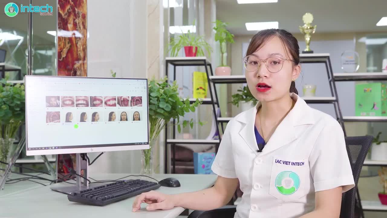 PHÂN TÍCH LÂM SÀNG CA NIỀNG RĂNG HÔ, KHẤP KHỂNH NẶNG VỚI BÁC SĨ CHUYÊN GIA TẠI HỆ THỐNG NHA KHOA LẠC VIỆT INTECH